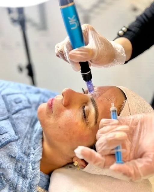 Benefits of Microneedling